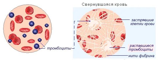 Кровь не сворачивается болезнь. Как выглядит свернувшаяся кровь.