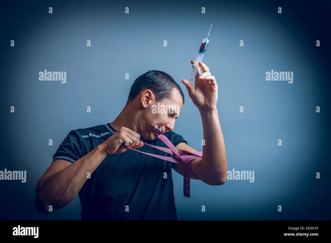 Жгут зубы. Шинирование стекловолоконной нитью. Минивинты ортодонтические. Вантовое шинирование зубов. Жгут зубы.