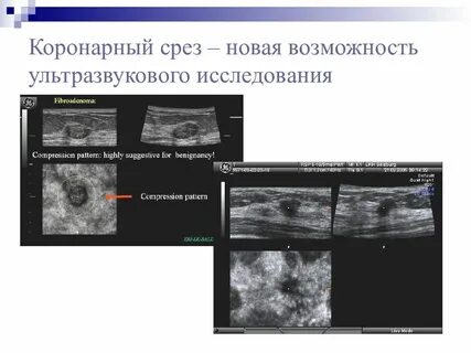 Срез исследования