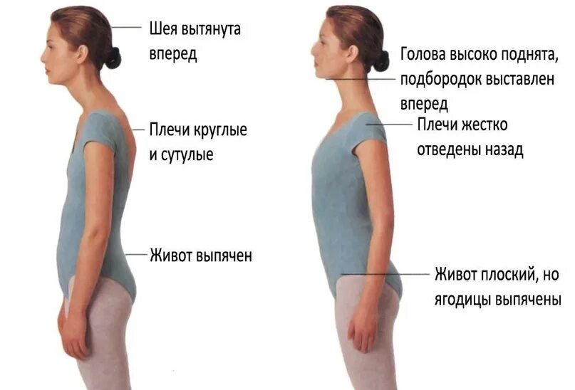 Почему голова вытянутая. Круглая спина. Ровная спина. Упражнения для сутулой спины. Плохая осанка.