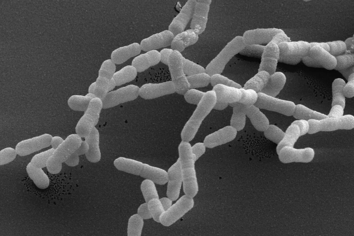 Бактерии можно обнаружить. Нитчатые бактерии (Sphaerotilus. Эггертелла лента. Eubacterium lentum Eggerthella lenta что это. Eggerthella SPP морфология.