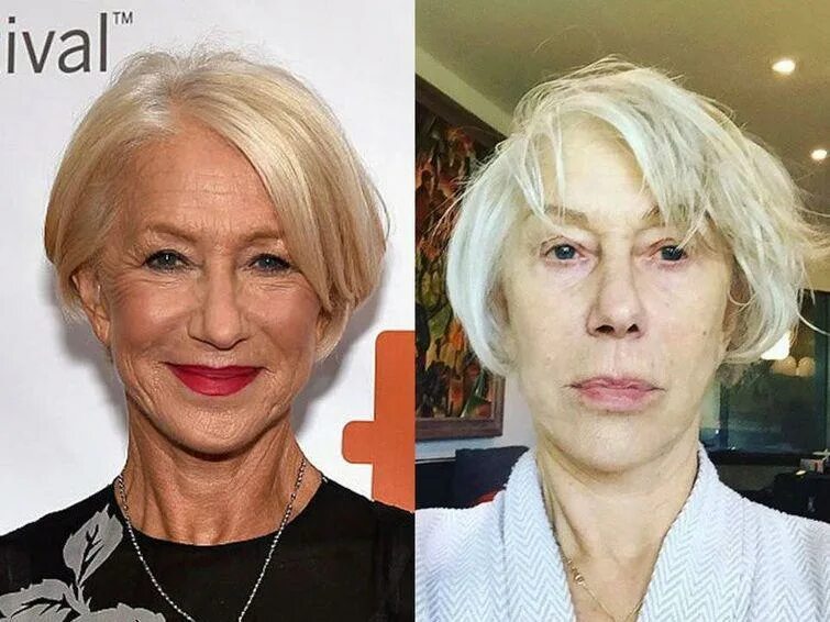 Пластика в 50 лет. Молодо выглядящие люди после 40. Дайан китон пластика. Прически с сединой. Стрижка для пожилой дамы.