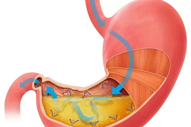 Повышенная кислотность желудка.