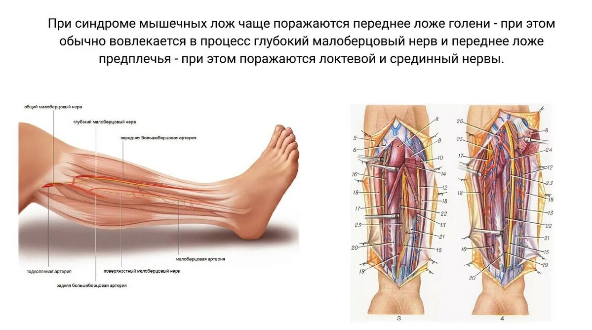 Суставно мышечный синдром. Суставно мышечный синдром