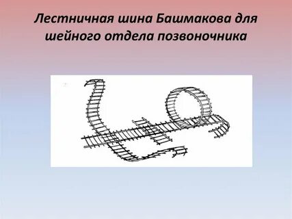 Лестничная шина