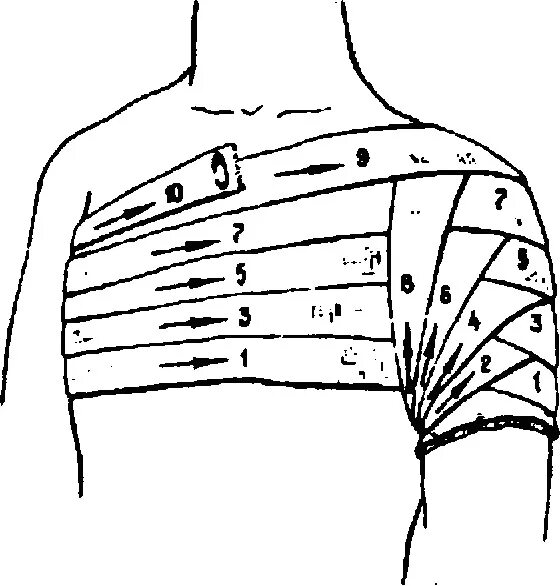 Плечевая повязка алгоритм. Колосовидная повязка на грудную клетку. Наложение колосовидной повязки на плечевой сустав. Повязка колосовидная на плечо и плечевой сустав. Техника наложения колосовидной повязки на плечо.