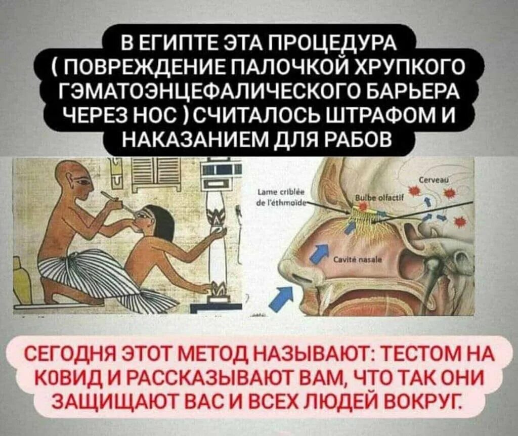 Наказание в древности. Наказание в древнем Египте. Наказание рабов в древнем Египте. Как наказывали в древнем Египте. Наказание палками в древнем Египте.