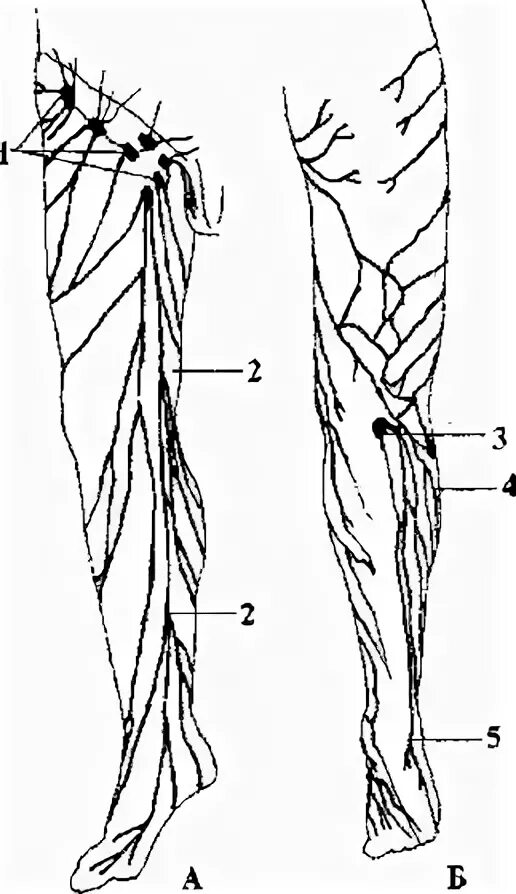 регионарные лимфоузлы нижней конечности. подколенные лимфатические узлы. лимфоток лимфоузлы нижняя конечность. лимфоузлы конечностей. лимфатические узлы нижней конечности схема.