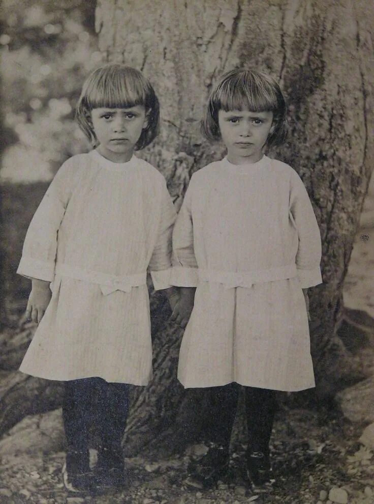Советские двойняшки. Советские близняшки. Сёстры кривошляповы сиамские близнецы. Кривошляповы маша и даша. Сиамские близнецы маша и даша 1950.