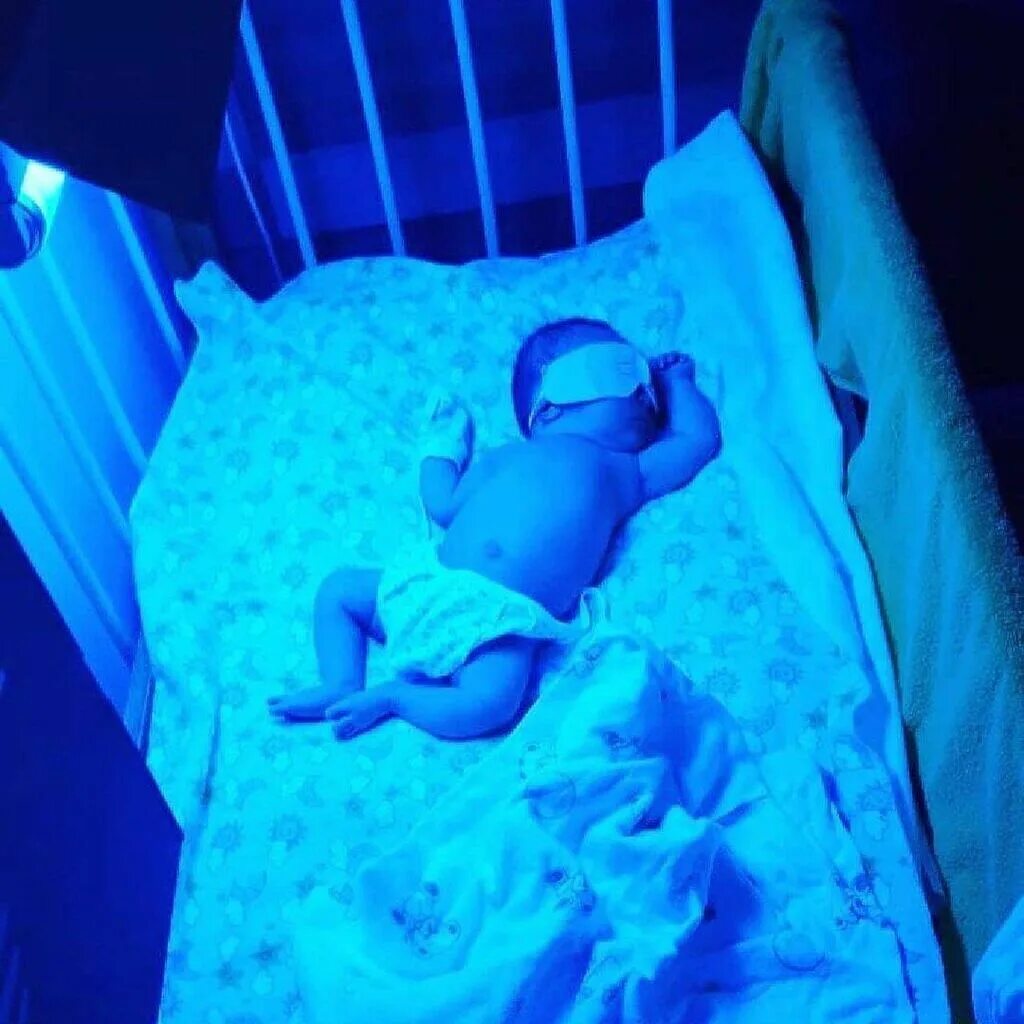 Ребенка держат под лампой. Ребенка держат под лампой. Лампа для фототерапии новорожденных. Ребенка держат под лампой. Уф лампа от желтушки для новорожденного.