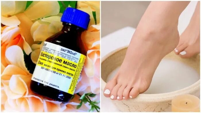 Масла для кожи ног. Избавляемся от натоптышей на ногах. касторовое масло от стержневой мозоли на ногах. касторовое масло от мозолей.