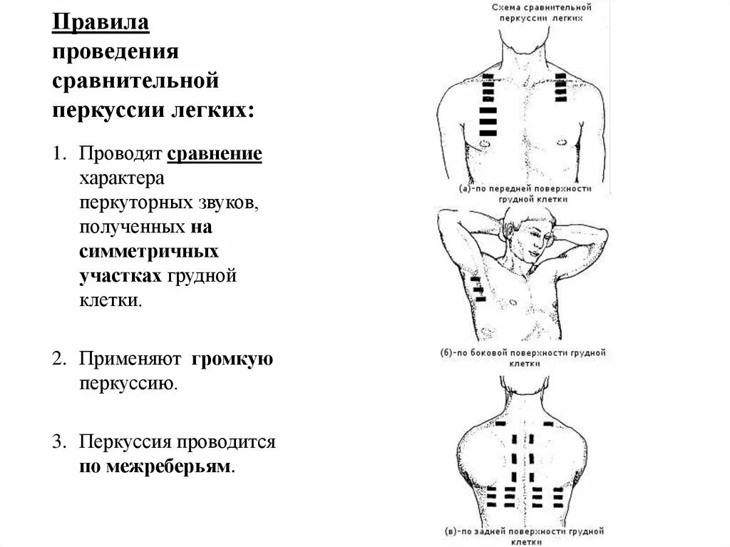 Топографические границы легких. Топографическая перкуссия легких точки. Топографическая перкуссия легких пропедевтика. Точки сравнительной перкуссии легких.