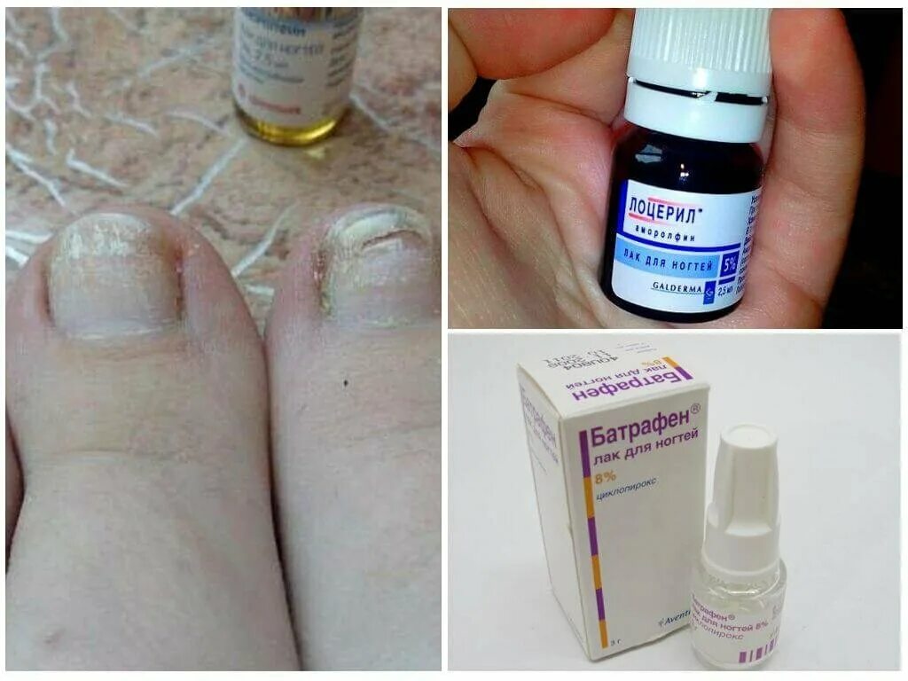 Лечение ногтей на ногах препараты отзывы. Препараты от грибка ногтей на ногах. Lanbena nail repair essence от грибка ногтей. Препараты от грибка ногтей. Lanbena эссенция для ногтей.
