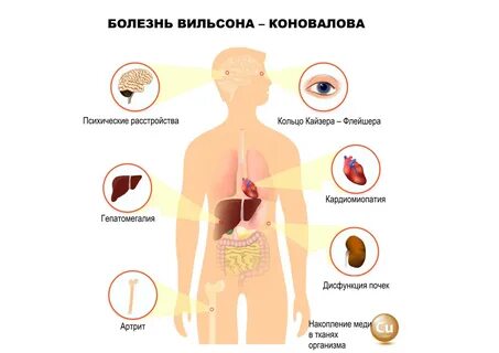 Симптомы болезни х