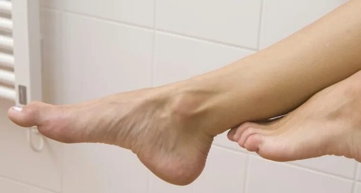 Болезнь ног гипергидроз. Воняют ноги причины