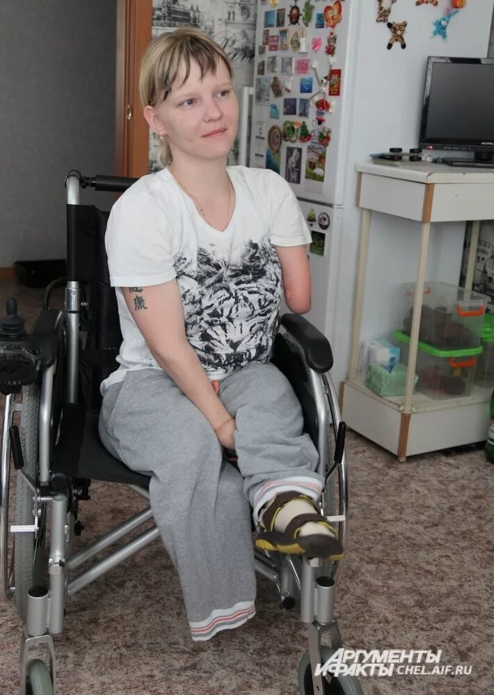 Ампути ксения гиниятуллина. Девушки инвалиды без ног и рук. Девушки инвалиды без ног и рук. Девушки инвалиды без ног и рук. Девушки инвалиды без рук.