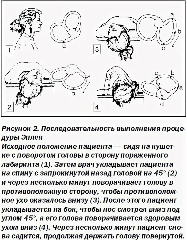 Головокружение лежа при повороте головы