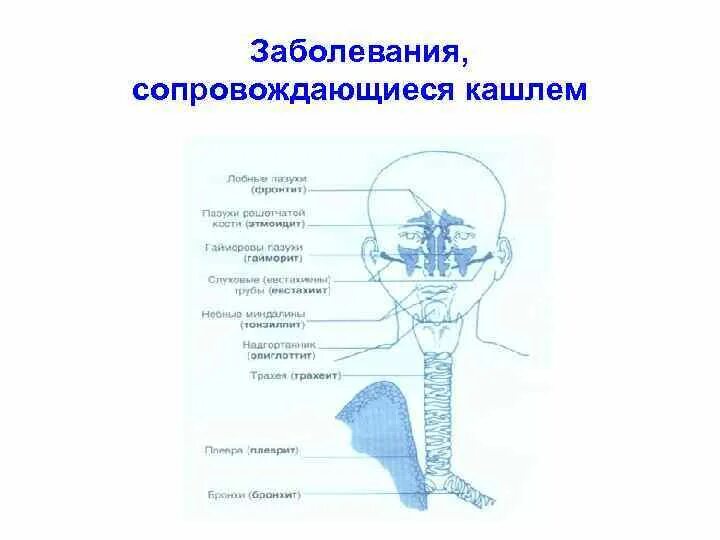 Заболевание сопровождающееся кашлем