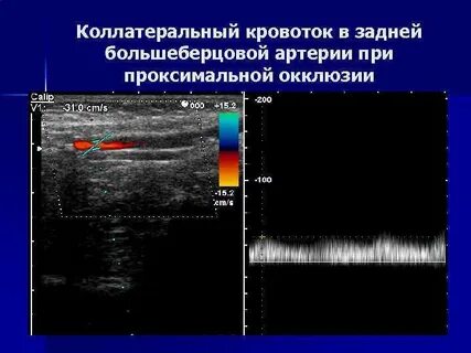 Наличие кровотока