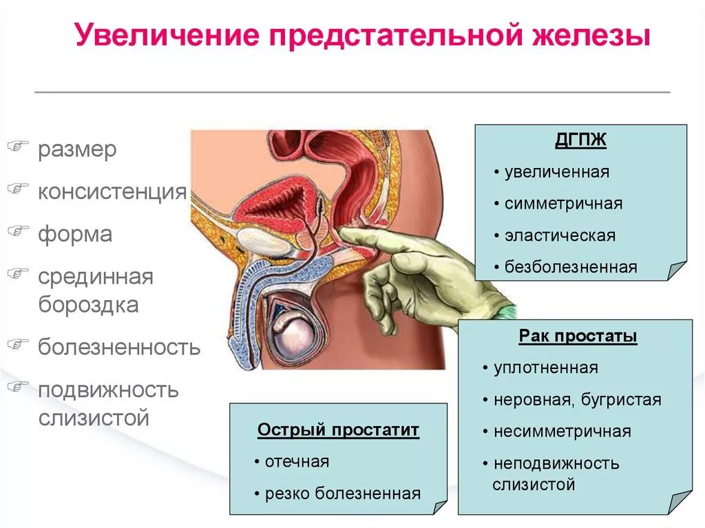 Простата форма