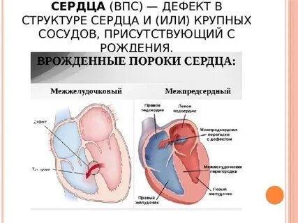 Феномен сердце