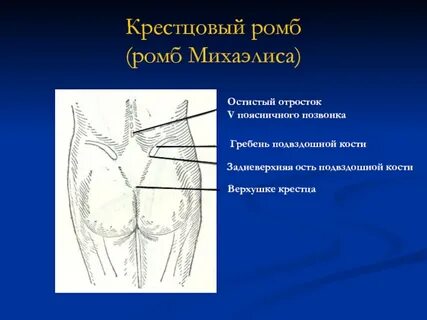 Ромб михаэлиса размеры