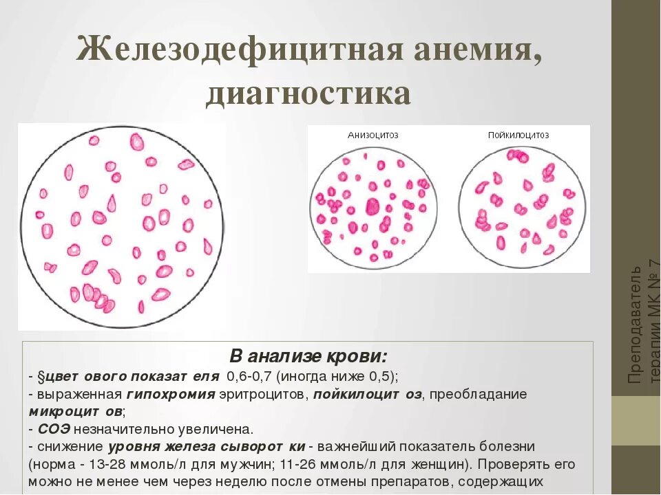 Мазок крови при выявлении патологии что это. Железодефицитная анемия кровь. Картина крови при железодефицитной анемии. Железодефицитная анемия анализ крови показатели.