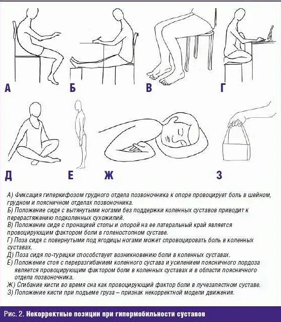 Подвижность суставов детей. Синдром гипермобильности суставов. Марфана гипермобильность суставов. Дисплазия соединительной ткани и гипермобильность суставов. Комплекс упражнений для развития гибкости таблица.