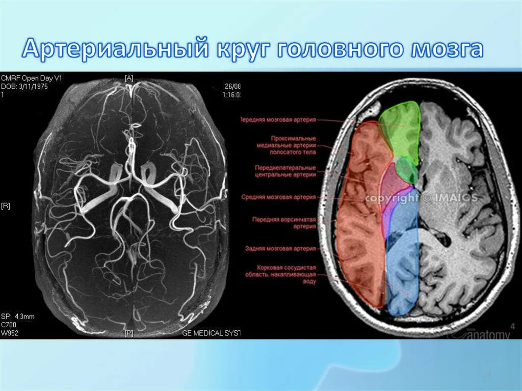Круги головного мозга. Артериальный круг головного мозга. Большой артериальный круг головного мозга. Цереброваскулярной недостаточност.