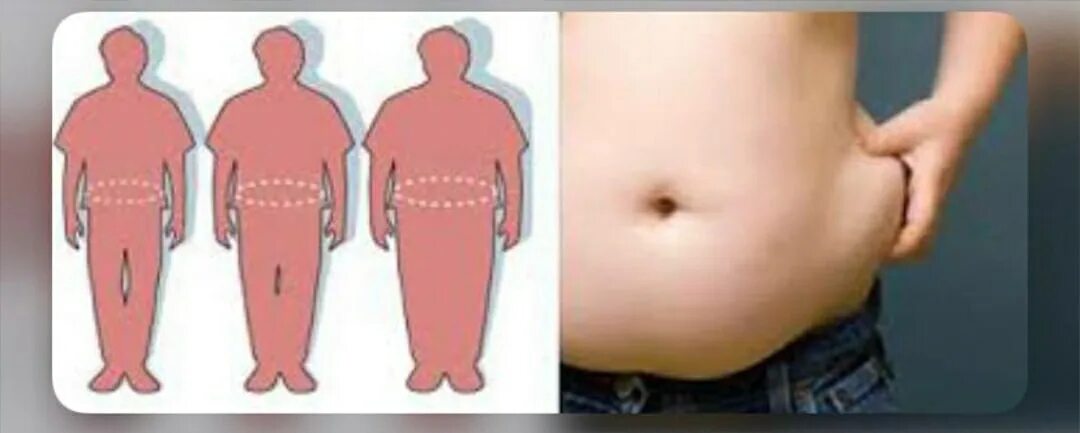 Гиноидное ожирение у мужчин. Гиноидный Тип ожирения груша. Ожирение по женскому типу. Ожирение по женскому типу у мужчин.