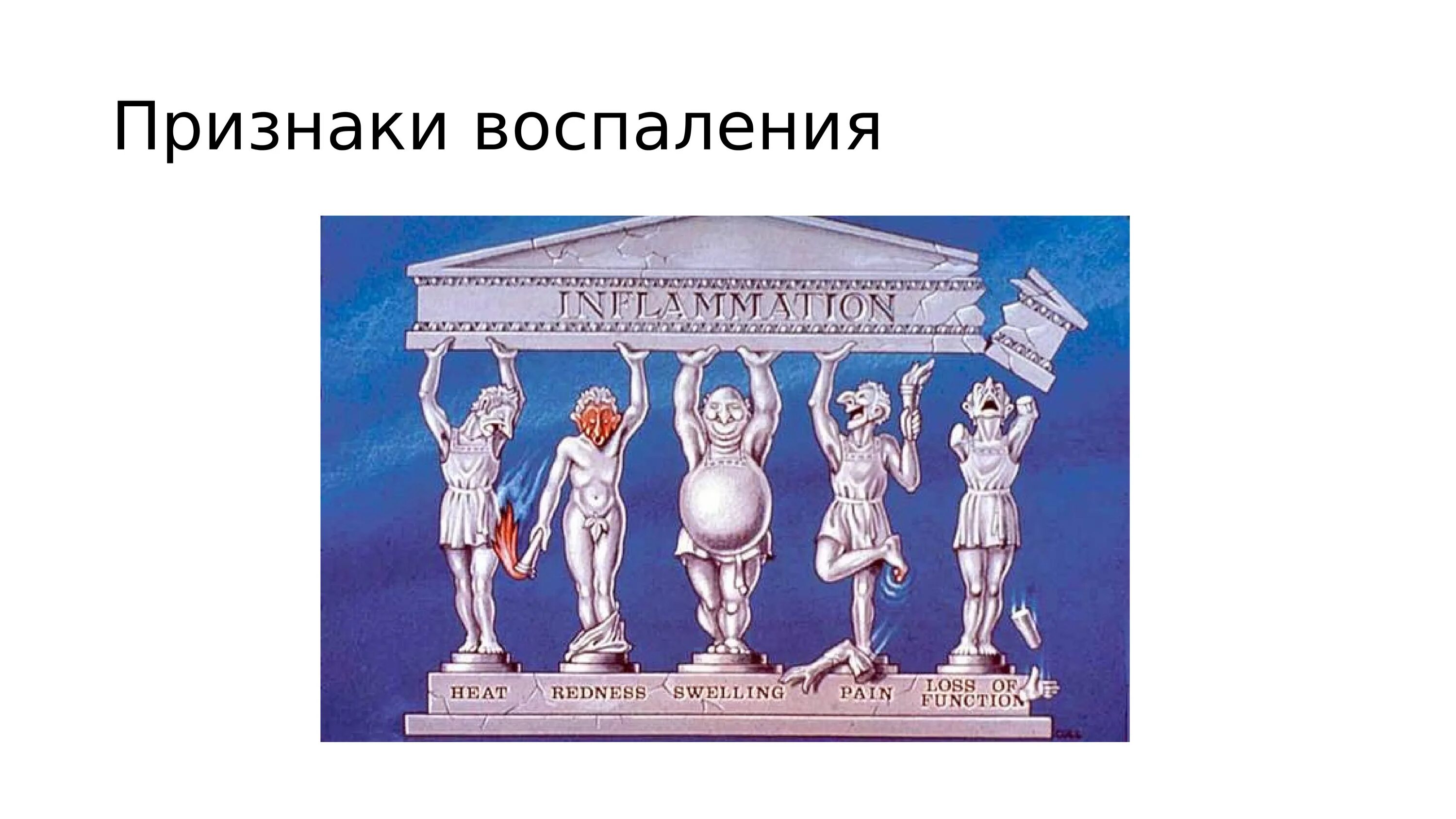 Признак воспаления dolor. Пять признаков воспаления. Признаки воспаления схема. Перечислите признаки воспаления. Местные признаки воспаления.