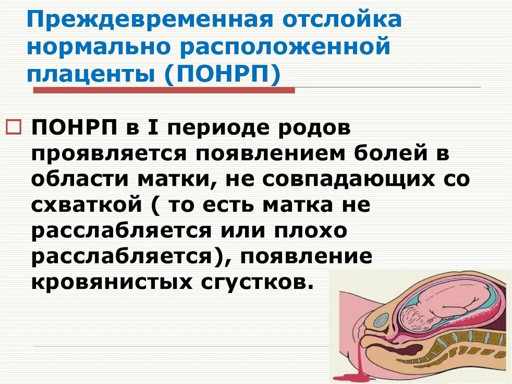 Причины преждевременной отслойки нормально расположенной плаценты. Отслойка нормально расположенной плаценты. Отслойка нормально расположенной плаценты симптомы. Преждевременная отслойка плаценты в родах.