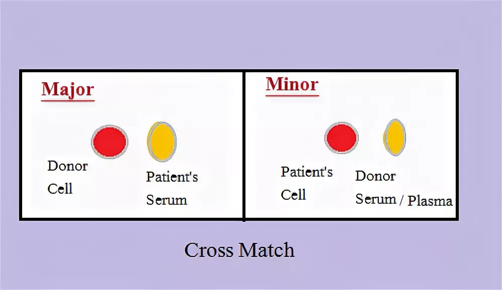 Cross match. Кросс матч при трансплантации почки. Cross Match тест. Кросс матч реакция. Кросс-матч тест трансплантация.