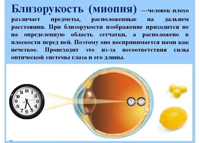 Можно вылечить миопию