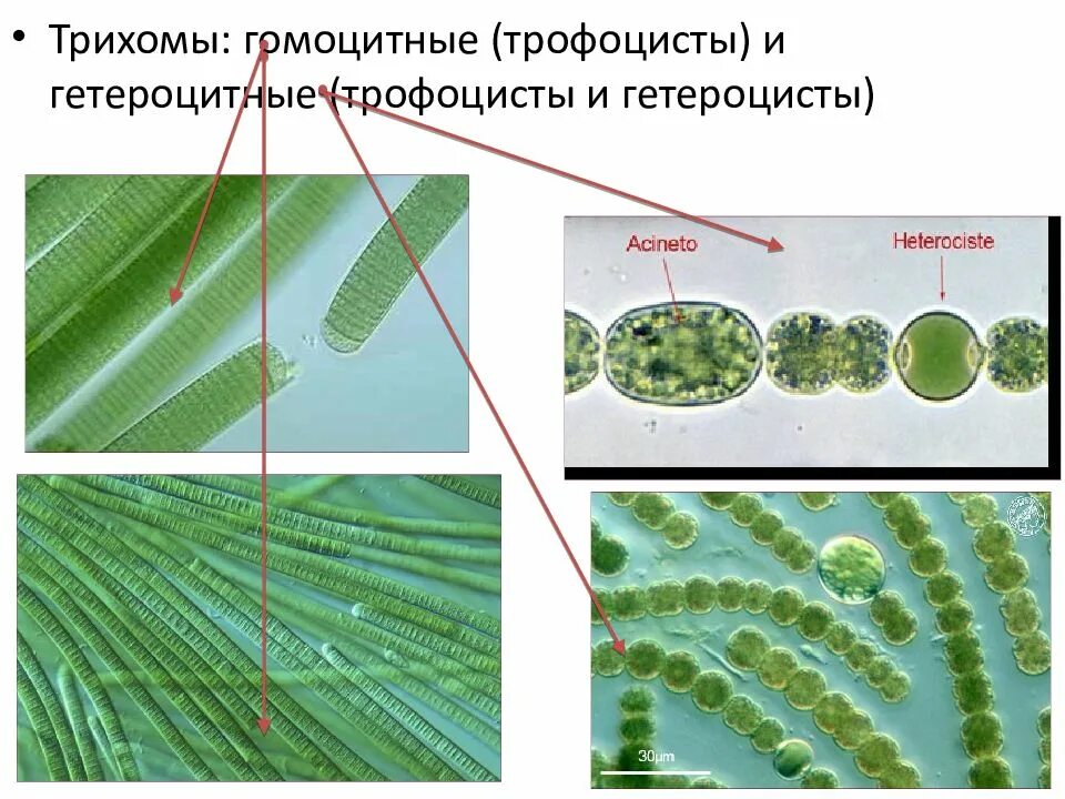 Цианобактерии относят к водорослям. Трихом цианобактерии. ГОМОЦИТНЫЙ таллом цианобактерии. Отдел цианобактерии сине-зеленые водоросли. Цианобактерии размножение.