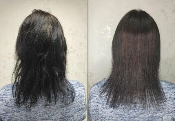 Сожженные волосы. Кератин на сожженные волосы. Сожженные волосы до и после. Пересушенные волосы после окрашивания. Выпадают волосы после покраски