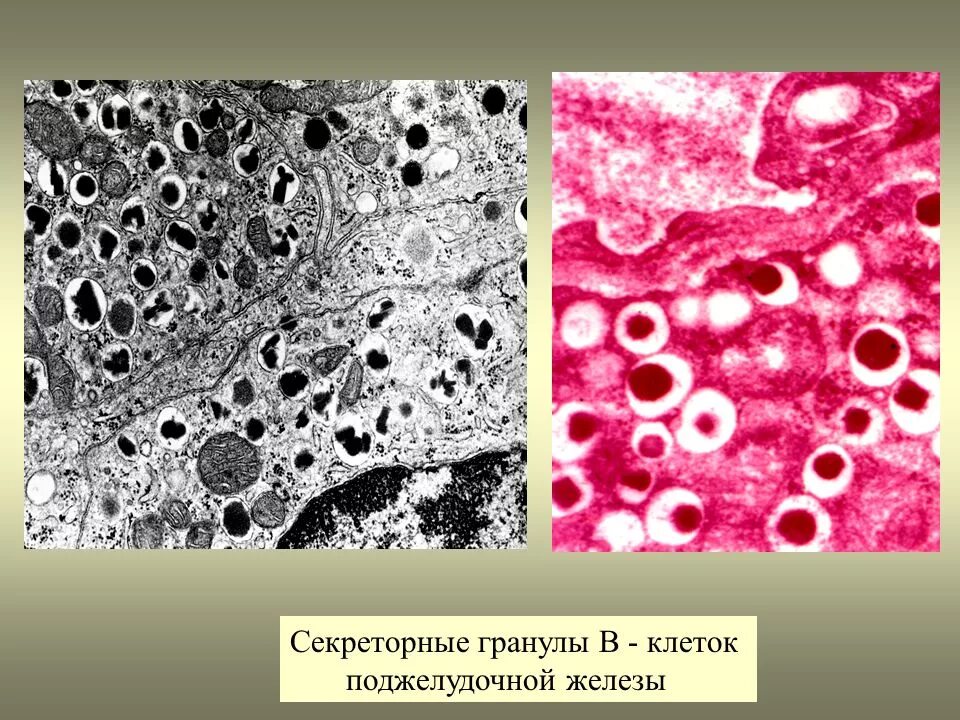 Гранула гистология. Секреторные гранулы в клетках лейдига. препарат секреторные гранулы в клетках лейдига кожи аксолотля. клетки лейдига кожи аксолотля. секреторные гранулы гистология.