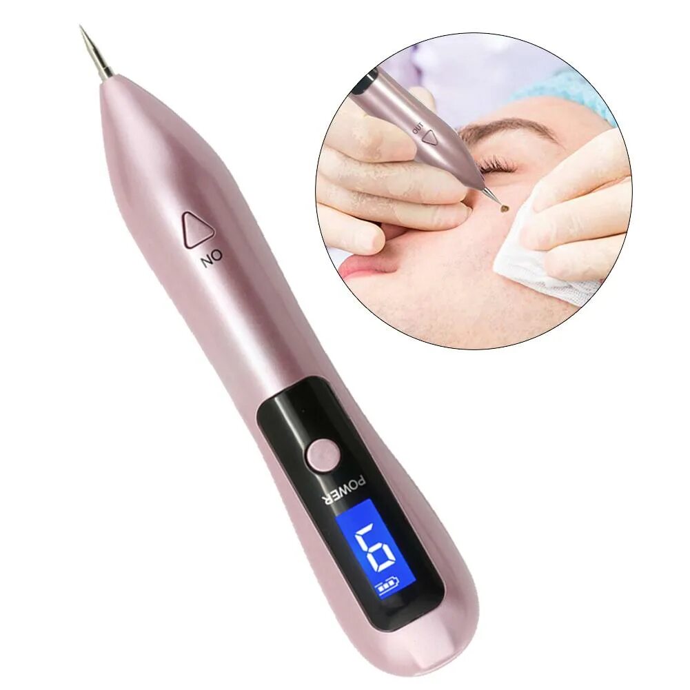 Ручка Mole removal Pen. Плазменная ручка для лица. Плазменная ручка омоложение. Mole pen