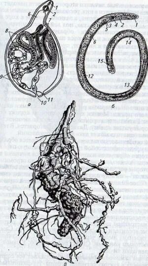Two views of the adult C. elegans intestine. A. An adult glp-4(bn2) C.... Downlo