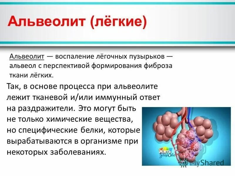жидкость в альвеолах легких. аллергический альвеолит патанатомия. воспалительный процесс в альвеолах. профессиональный экзогенный аллергический альвеолит патогенез. пневмония воспаление легких.