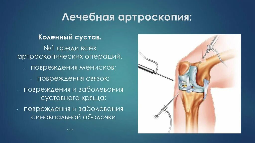 Где сделать операцию на коленном суставе