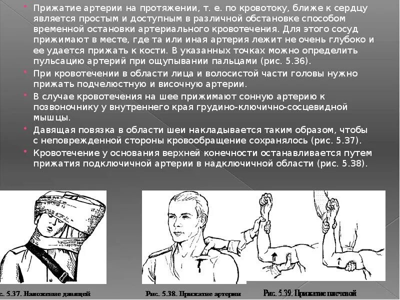 Остановить кровотечение на сонной артерии ответ тест. Способы временной остановки кровотечения из сонной артерии. Наложение артериального жгута на шею. Наложение жгута при кровотечениях на шею. Остановка кровотечения жгутом на шее.