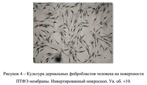Культура фибробластов