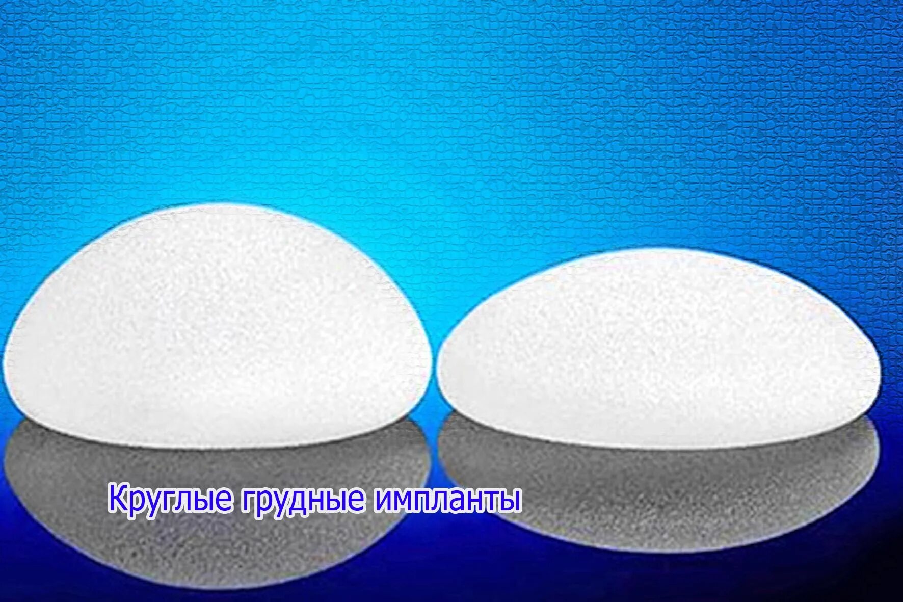 Силиконовые импланты. Разрыв импланта молочной железы. Узи импланта молочной железы. Импланты mentor 400ml. Протез молочной железы.