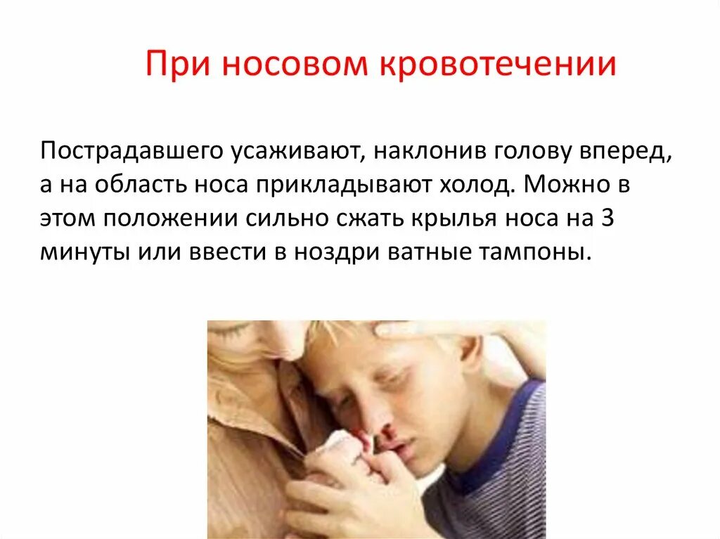 Кровь носом у ребенка 8 лет причины. При носовом кровотечении. Причины носового кровотечения.