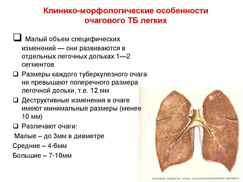 Очаговая форма туберкулеза. Очаговый туберкулез схема. Формы очагового туберкулеза. Очаговый туберкулез легких. Мягкоочаговый туберкулез легких.