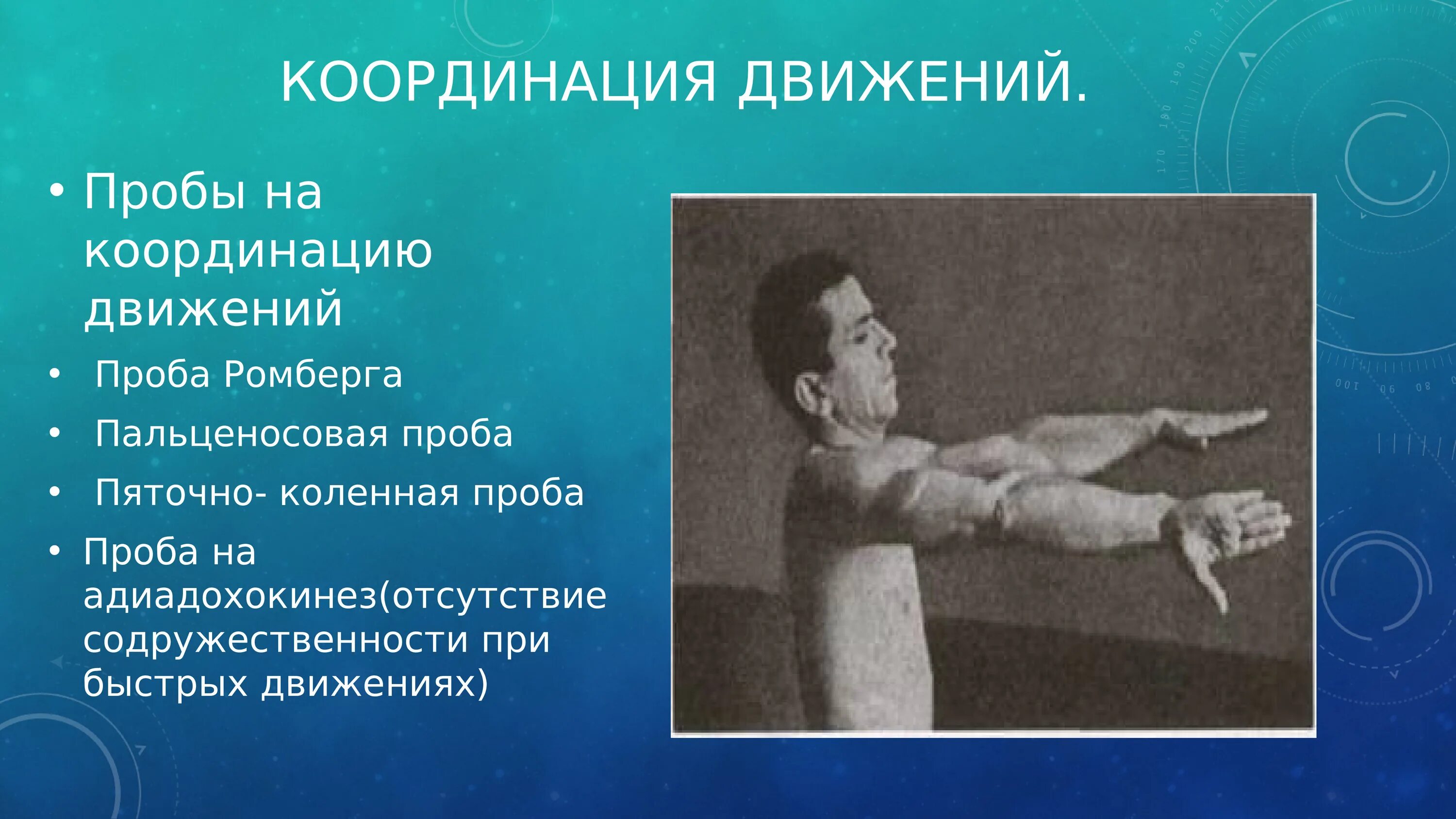 Исследование координации. Пробы на координацию движений. Проба на адиадохокинез. ПРРЬА на илиодохокинез. Пробы на координацию движений пяточно.