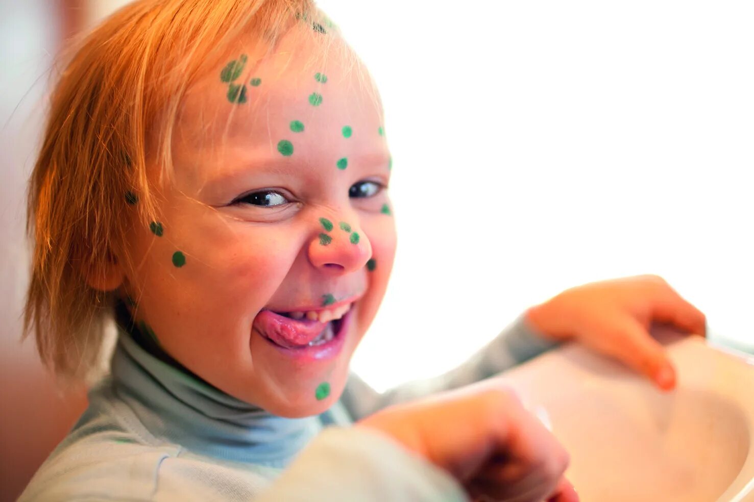 Ветрянка ветряная оспа. Гангренозная ветрянка. Поксклин лекарство от ветрянки. Ветрянка ветряная оспа у детей. Ветрянка консультация для родителей в детском саду.