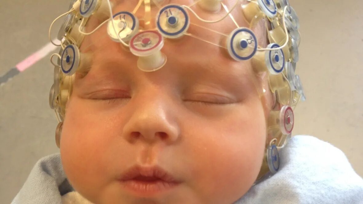 Мозг ребенка видео. Шлем для головы для развития мозга. Развиваем мозг ребенка. Бак головного мозга детям.
