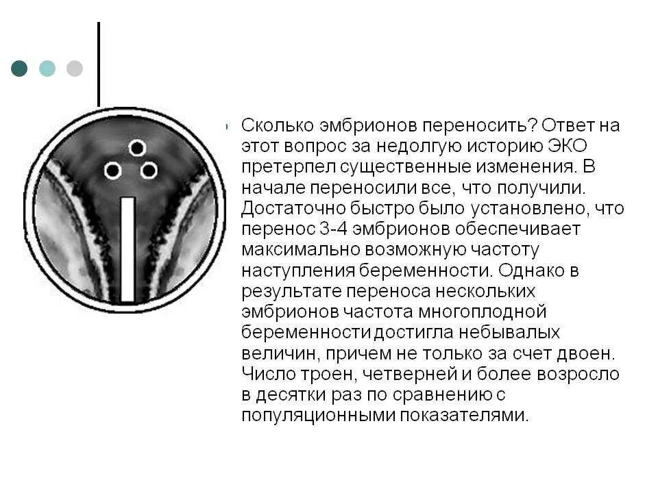 Подсадка эко отзывы. Сколько переносят эмбрионов при эко. перенос эмбрионов при эко рекомендации. подсадка эмбрионов при эко на 5.